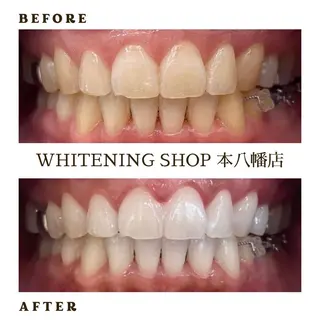 メンズ ホワイトニング ショップ本八幡店のエステ・リラクイメージ