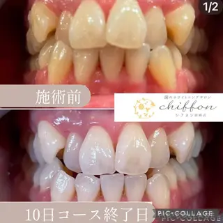 歯科レベルの白さ💎 ✨ホワイトニング岡崎のエステ・リラクイメージ