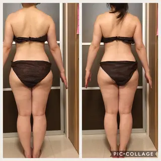 セミロング カラー パーマ ヘアアレンジ メンズ キッズ ネイル マツエク・マツパ アニメ,Vオタク× 即効痩せエステサロンのエステ・リラクイメージ