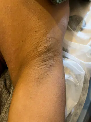 yellow.所属・yellow💛【 脱毛&フェイシャル】のエステ・リラクイメージ