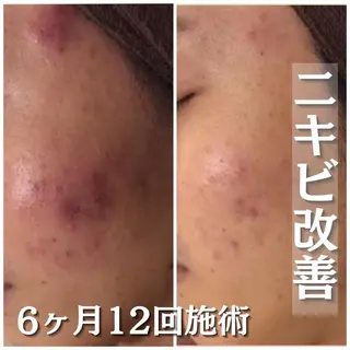 セミロング カラー パーマ ヘアアレンジ メンズ キッズ ネイル マツエク・マツパ アイブロウ 触れたくなる モテ肌へ...❤︎のエステ・リラクイメージ