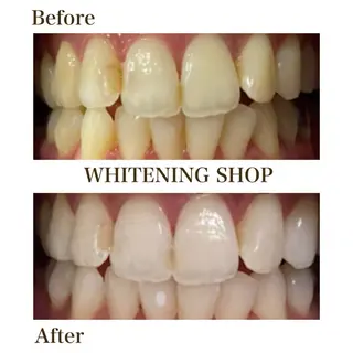 セルフホワイトニングショップ静岡葵区店所属・もえか静岡葵区店ホ ワイトニングショップのその他イメージ