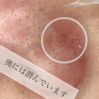 eyelashsalon Plaisir所属・ツカハラ ミカのエステ・リラクイメージ