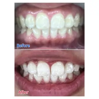 MBEAUTYSALON 千葉店・京成大久保所属・Melty 輝のその他イメージ