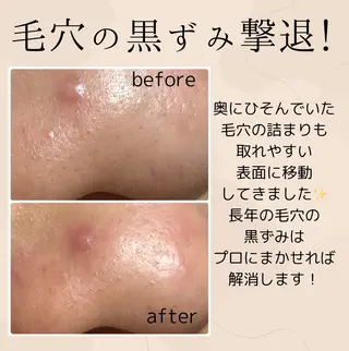 小顔・毛穴・たるみ ネイル　　似内真樹のエステ・リラクイメージ