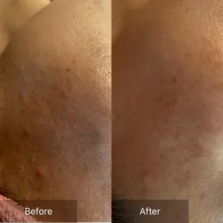 Mandarin Orange所属・毛穴から始める肌メン テマンダリンオレンジのエステ・リラクイメージ