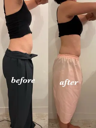 腸活サポート みなみののエステ・リラクイメージ