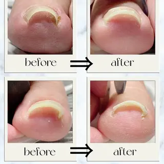 ネイル NAIL K-PIT ネイル ケーピットのネイルデザイン