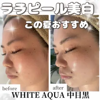 中目黒ハーブピーリン グ🌿ララピールのエステ・リラクイメージ