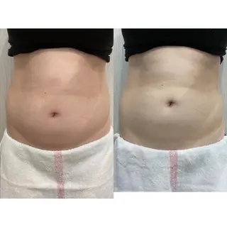 OPREA 千種店のエステ・リラクイメージ