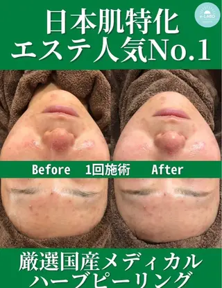 e-LABO こいずみのエステ・リラクイメージ