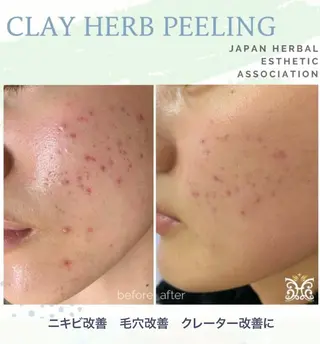 美肌&アロマ🌙 nana 目白/池袋のエステ・リラクイメージ