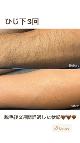 Cre A.所属・プライベートサロン Cre A.のエステ・リラクイメージ