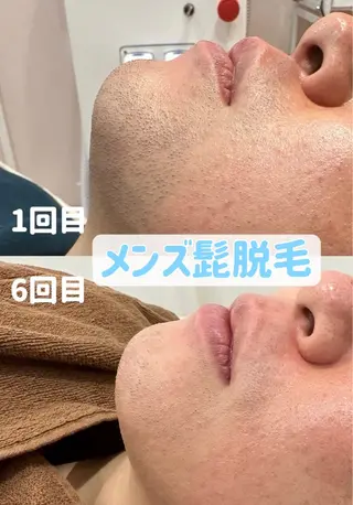 メンズ キッズ Amaryllis 🌹松本のエステ・リラクイメージ