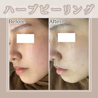 セミロング カラー パーマ ヘアアレンジ メンズ キッズ ネイル マツエク・マツパ Amaryllis 🌹松本のエステ・リラクイメージ