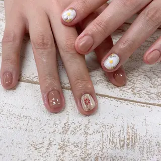 ネイル 巻き爪補正 Umber　Miyaのネイルデザイン