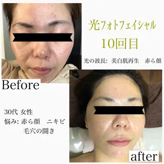 美肌脱毛と癒しのプライベートサロン。gratia~グレイティア~所属・gratia ~グレイティア~のエステ・リラクイメージ