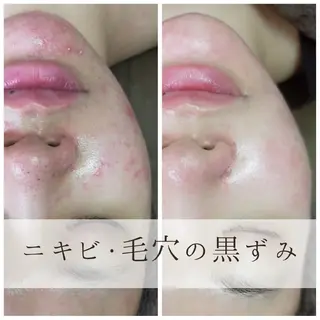 痩身・小顔salon 🌿‬北18条サロンのエステ・リラクイメージ