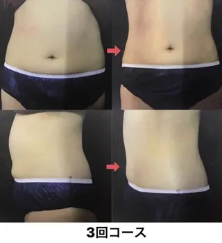 横浜エステサロン R-ing リングのエステ・リラクイメージ