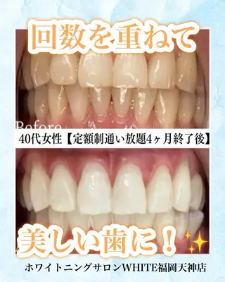 メンズ ホワイトニング専門店 WHITE天神店のエステ・リラクイメージ
