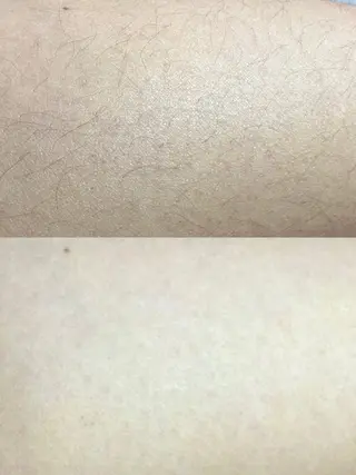 Hit. シュガーリング豊橋のエステ・リラクイメージ