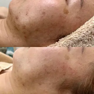 Beauty Salon Ciel　Chiba所属・BeautySalo nCielChibaのエステ・リラクイメージ