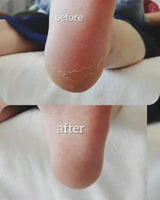 Glanz (グランツ)のエステ・リラクイメージ