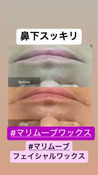 産毛専門店 Bittoのエステ・リラクイメージ