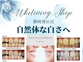 ホワイトニングショップ静岡葵区店所属・ホワイトニング ショップ静岡葵区店のその他イメージ