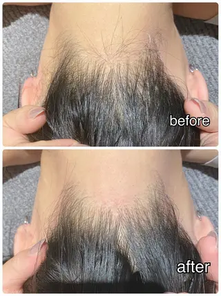 【痩身・脱毛サロン】 REBISKIN🌱のエステ・リラクイメージ