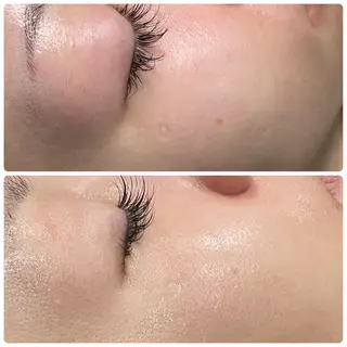 LiZA エステティックサロンのエステ・リラクイメージ