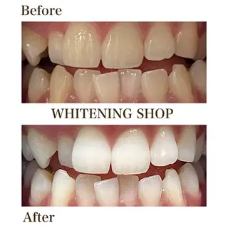 ホワイトニング ショップ川越店のエステ・リラクイメージ