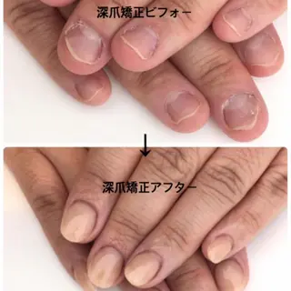 ネイル Alice マツエク&ネイル2のネイルデザイン