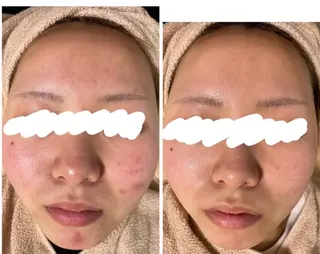 都度払い肌改善専門店 店長二上文香のエステ・リラクイメージ