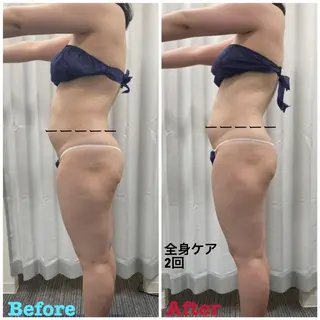 透明感の肌Lino malieのエステ・リラクイメージ