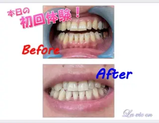 セルフホワイトニングサロン　ラヴィアン所属・ホワイトニングサロン La vie enのその他イメージ