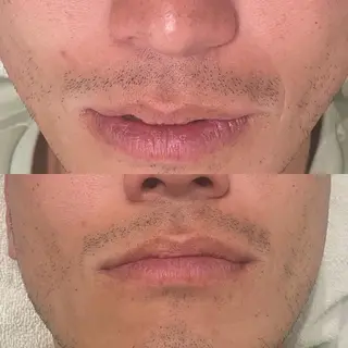 そノさき所属・大阪のシーサー🦁 島袋のエステ・リラクイメージ