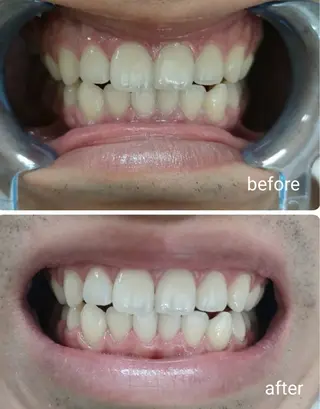 ecxia新宿西口店所属・セルフホワイトニング エクシア新宿西口店のその他イメージ