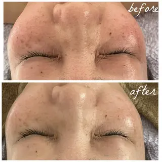 メンズ メナード岐阜茜部 杉浦のエステ・リラクイメージ