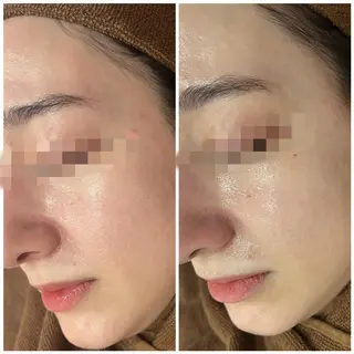 セミロング カラー パーマ ヘアアレンジ メンズ キッズ ネイル マツエク・マツパ アイブロウ Amaryllis 🌹松本のエステ・リラクイメージ