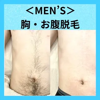 メンズ メディカルエステ マドンナのエステ・リラクイメージ