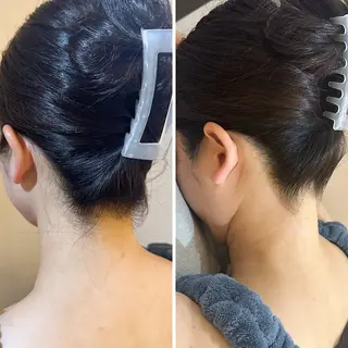 うなじ脱毛/美肌脱毛 LABELのエステ・リラクイメージ