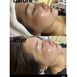 鍼灸サロン mahorobaトモのエステ・リラクイメージ