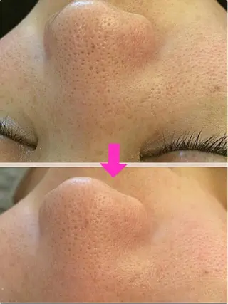 痩身リンパダイエット 隠れ家サロンチャームのエステ・リラクイメージ