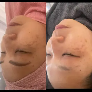 beauty lanaのエステ・リラクイメージ