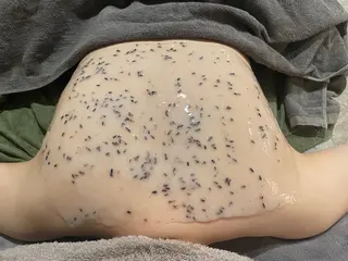 Meupニキビ専門店 背中/ハーブ/ララのその他イメージ