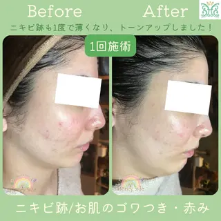 剥離するハーブ🌈 Honey Sideのエステ・リラクイメージ