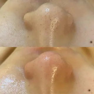 BELCIA福岡店　récolte de BELCIA（レコルトデベルシア）所属・BELCIA福岡店 レコルトデベルシアのエステ・リラクイメージ