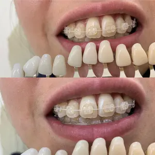 217whitening  room所属・217 ホワイトニングルームのエステ・リラクイメージ