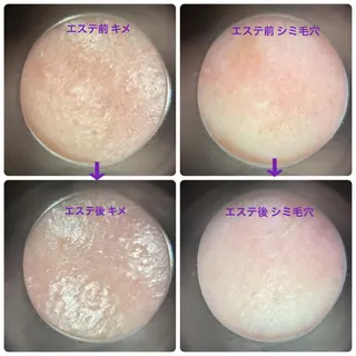 メナードフェイシャルサロン昭和円上所属・メナード昭和円上 いのうえのエステ・リラクイメージ